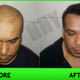 Hair Harmony & You Specialist In Hair Transplant Image 1