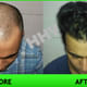 Hair Harmony & You Specialist In Hair Transplant Image 2
