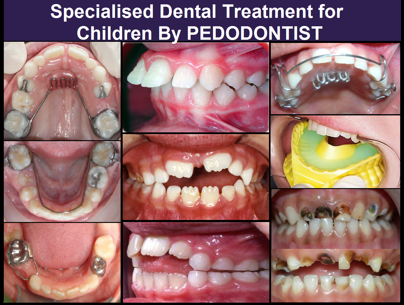 Manyalok Super Speciality - Orthodontics Implant & Pediatric Dentistry Image 9