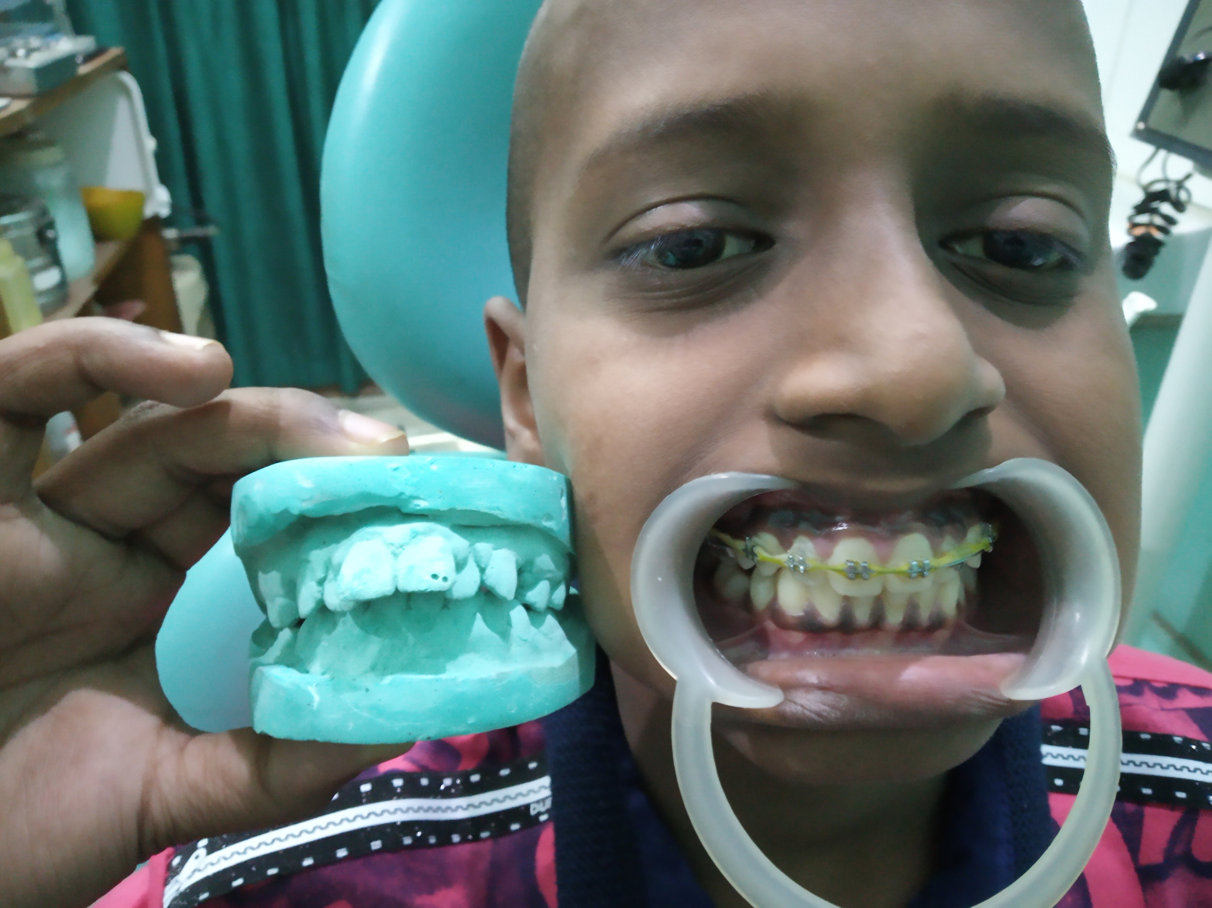 Manyalok Super Speciality - Orthodontics Implant & Pediatric Dentistry Image 10