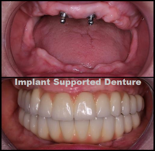 Magadh Oro Dental - Implant & Orthodontic Clinic Image 1