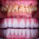 Magadh Oro Dental - Implant & Orthodontic Clinic Image 5