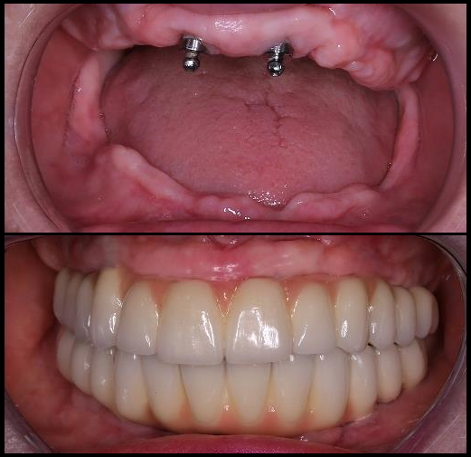 Magadh Oro Dental - Implant & Orthodontic Clinic Image 3