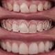 Magadh Oro Dental - Implant & Orthodontic Clinic Image 4