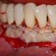 Magadh Oro Dental - Implant & Orthodontic Clinic Image 9