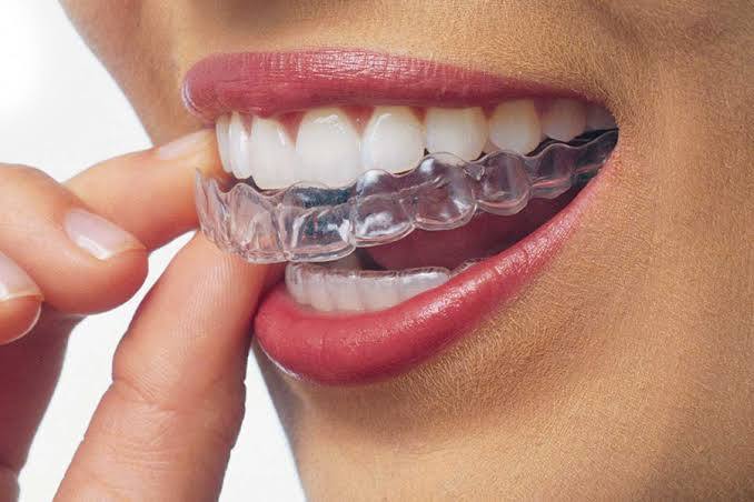 Magadh Oro Dental - Implant & Orthodontic Clinic Image 7