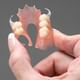 Magadh Oro Dental - Implant & Orthodontic Clinic Image 10