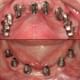 Magadh Oro Dental - Implant & Orthodontic Clinic Image 6