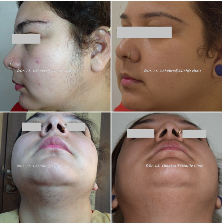Dr. Chhabra's Skinlife Clinic Image 10