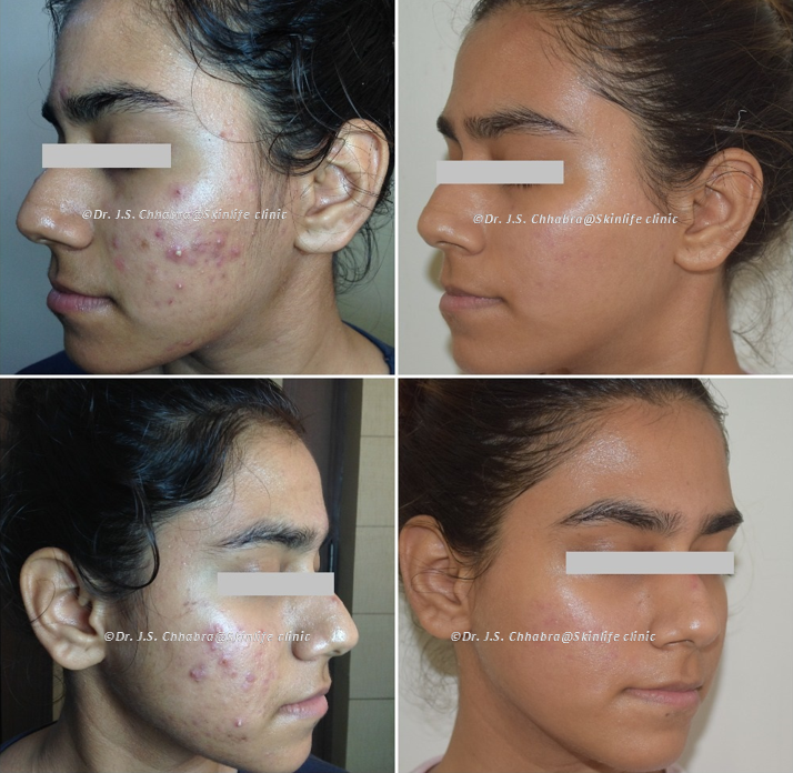 Dr. Chhabra's Skinlife Clinic Image 8