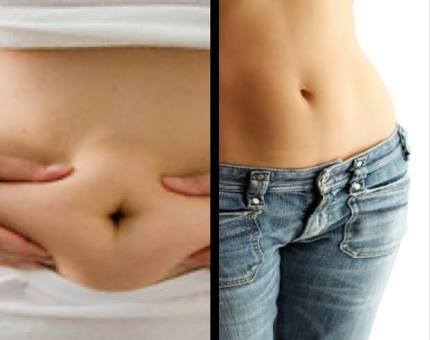 The Slimming Clinic by Dr Umang Image 4