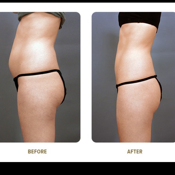 The Slimming Clinic by Dr Umang Image 6