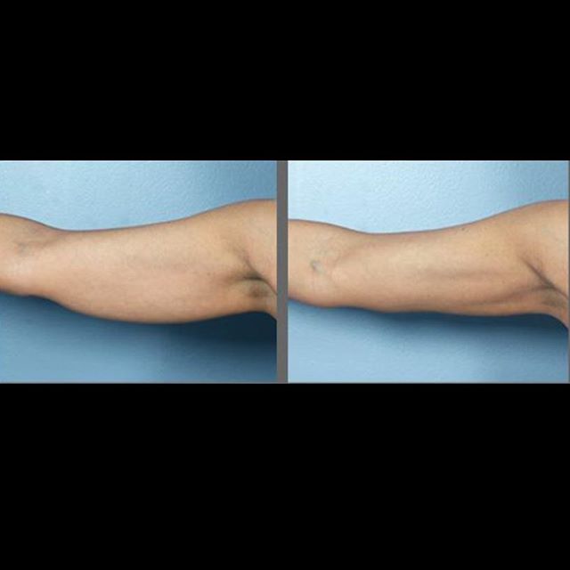 The Slimming Clinic by Dr Umang Image 9