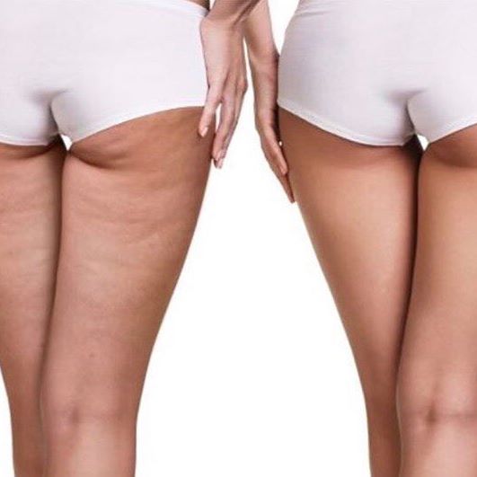 The Slimming Clinic by Dr Umang Image 10