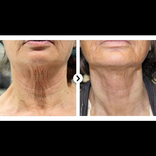 The Slimming Clinic by Dr Umang Image 7