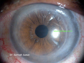CORNEA EYE HOSPITAL Image 1