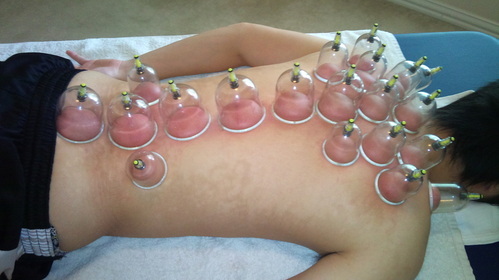 Hijamah Centre and Unani Medicine Image 2