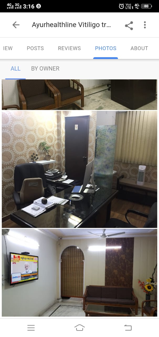Ayurhealthline Vitiligo Clinic Image 2