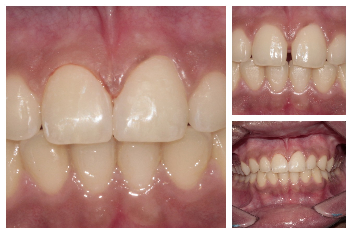 Bhandari Dental Clinic Image 10