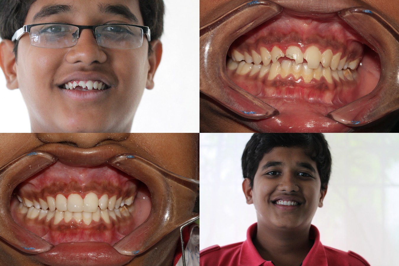 Bhandari Dental Clinic Image 9