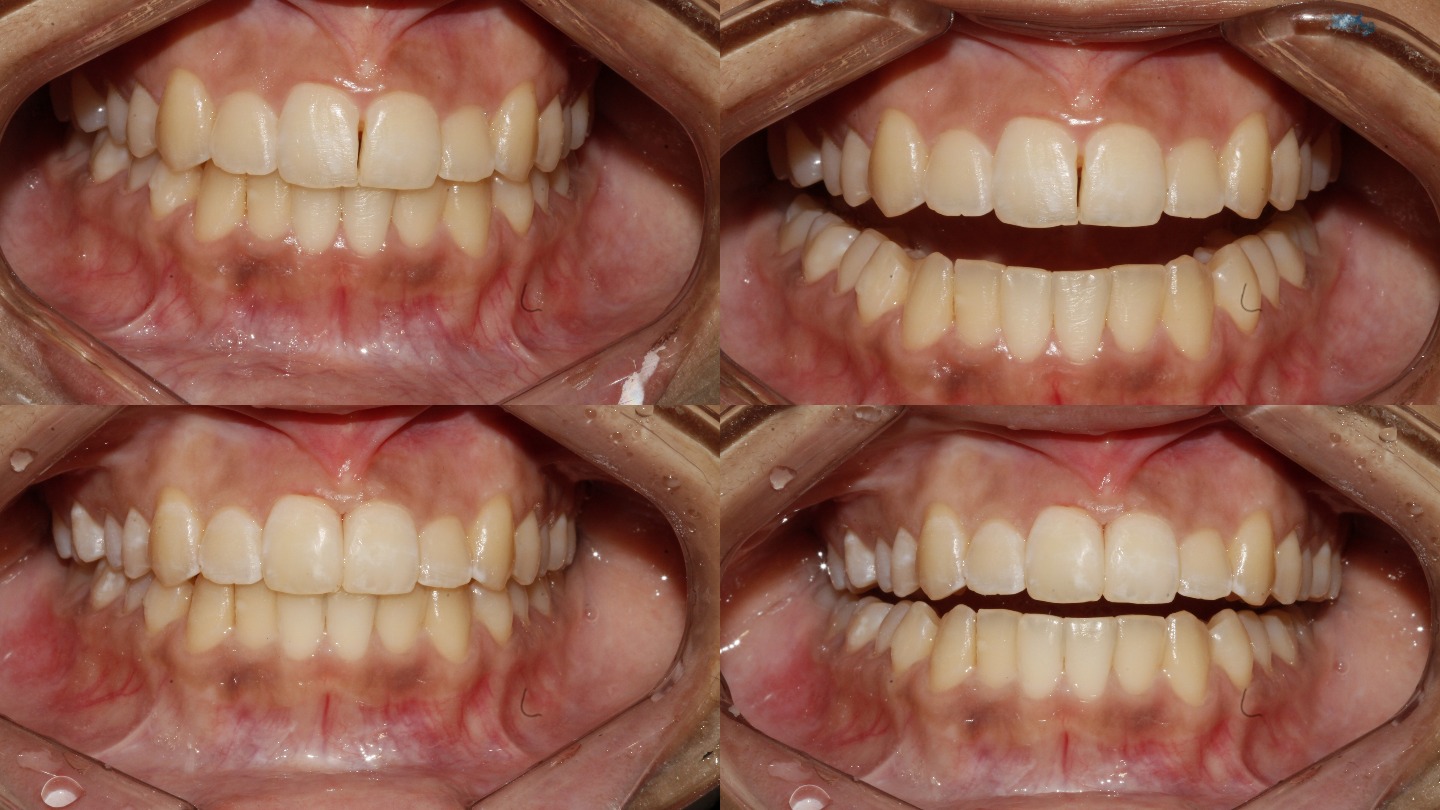 Bhandari Dental Clinic Image 8
