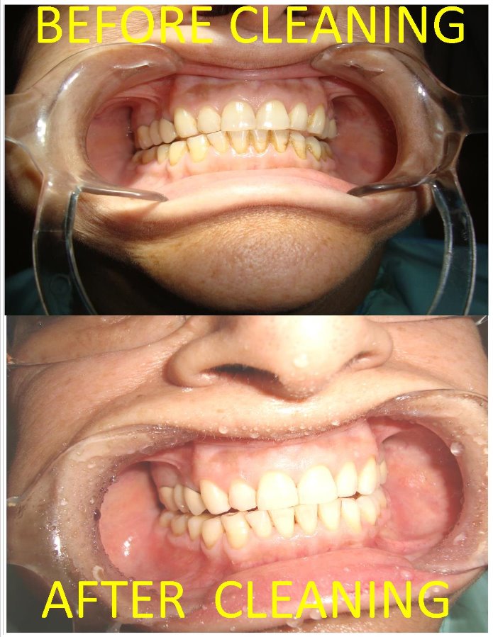 We Relieve Your Pain At Karun'S Dental Clinic Image 2