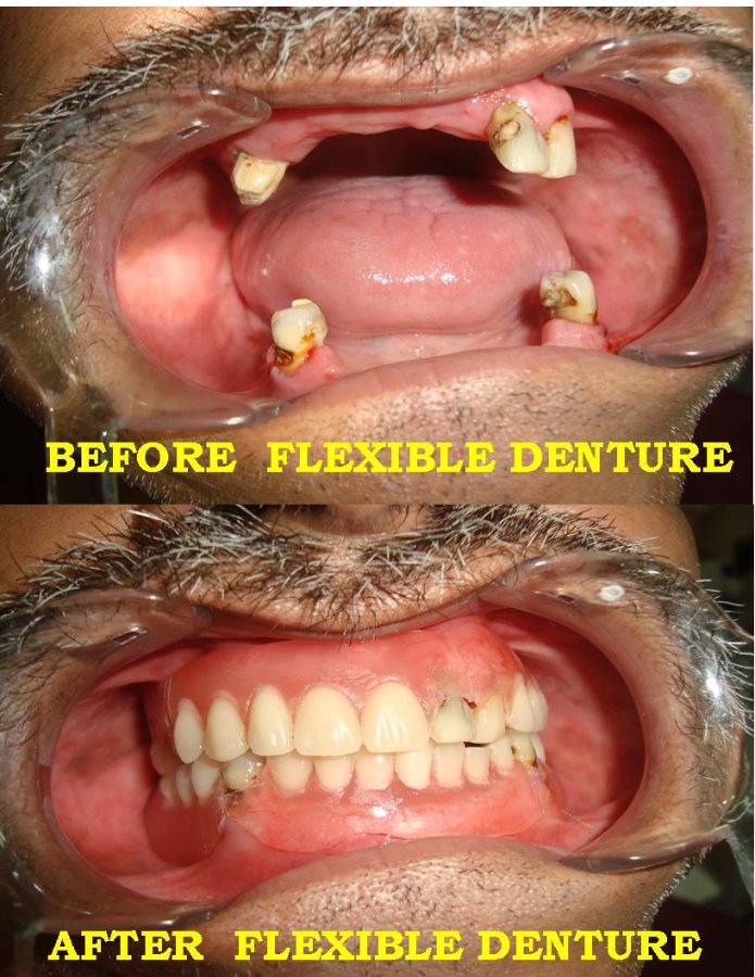 We Relieve Your Pain At Karun'S Dental Clinic Image 3