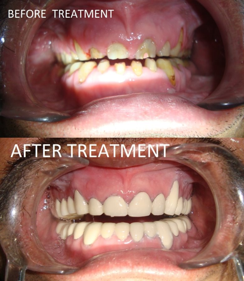 We Relieve Your Pain At Karun'S Dental Clinic Image 1