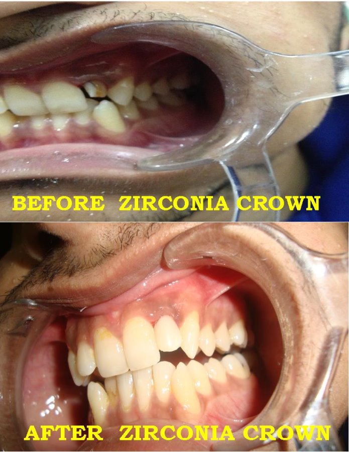 We Relieve Your Pain At Karun'S Dental Clinic Image 4