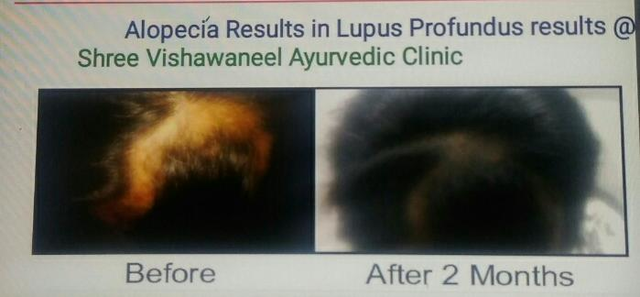 Shree Vishwaneel Ayurvedic Clinic & Panchkarma Centre Image 1