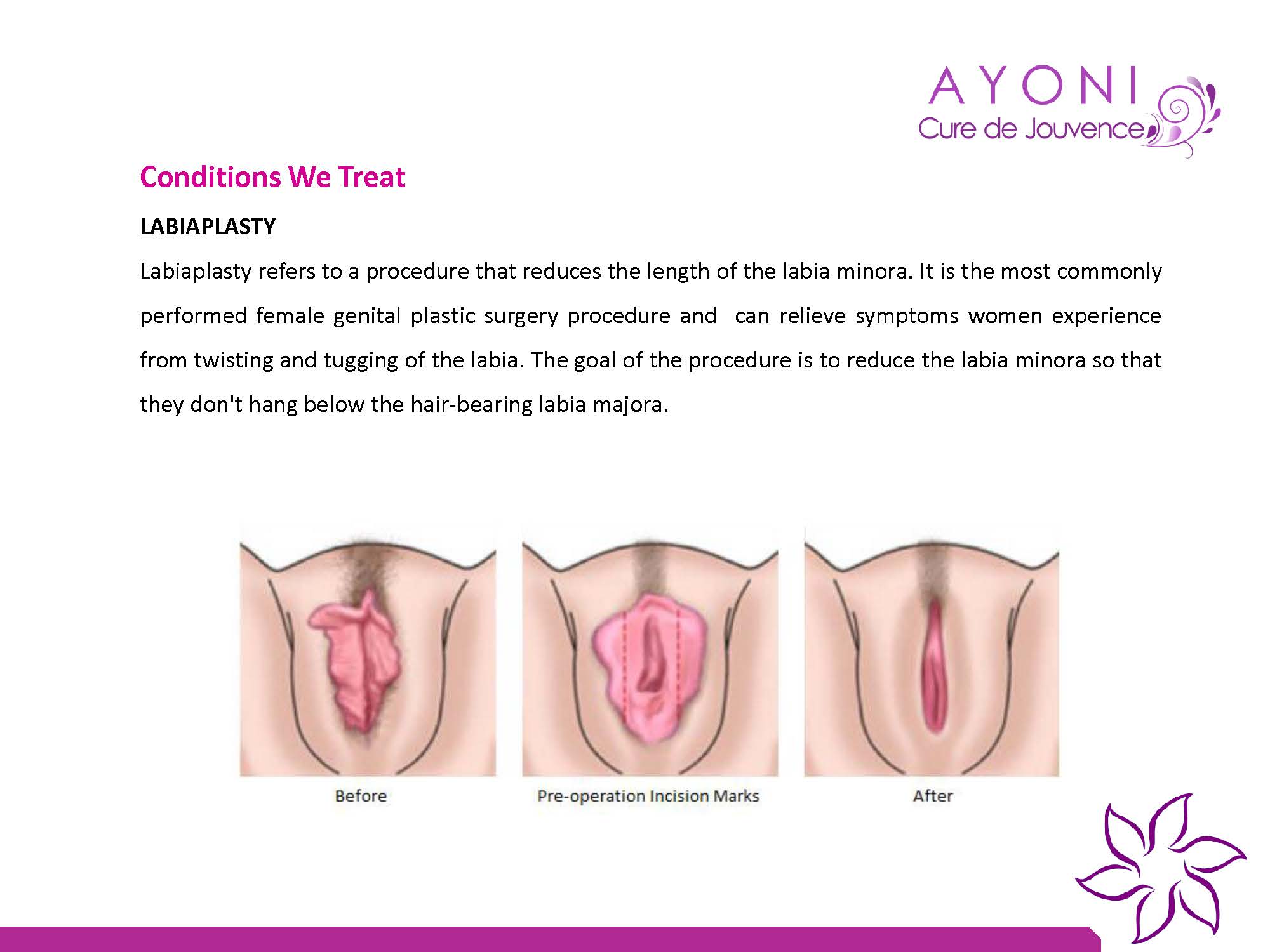 Ayoni Cure De Jouvence Image 5