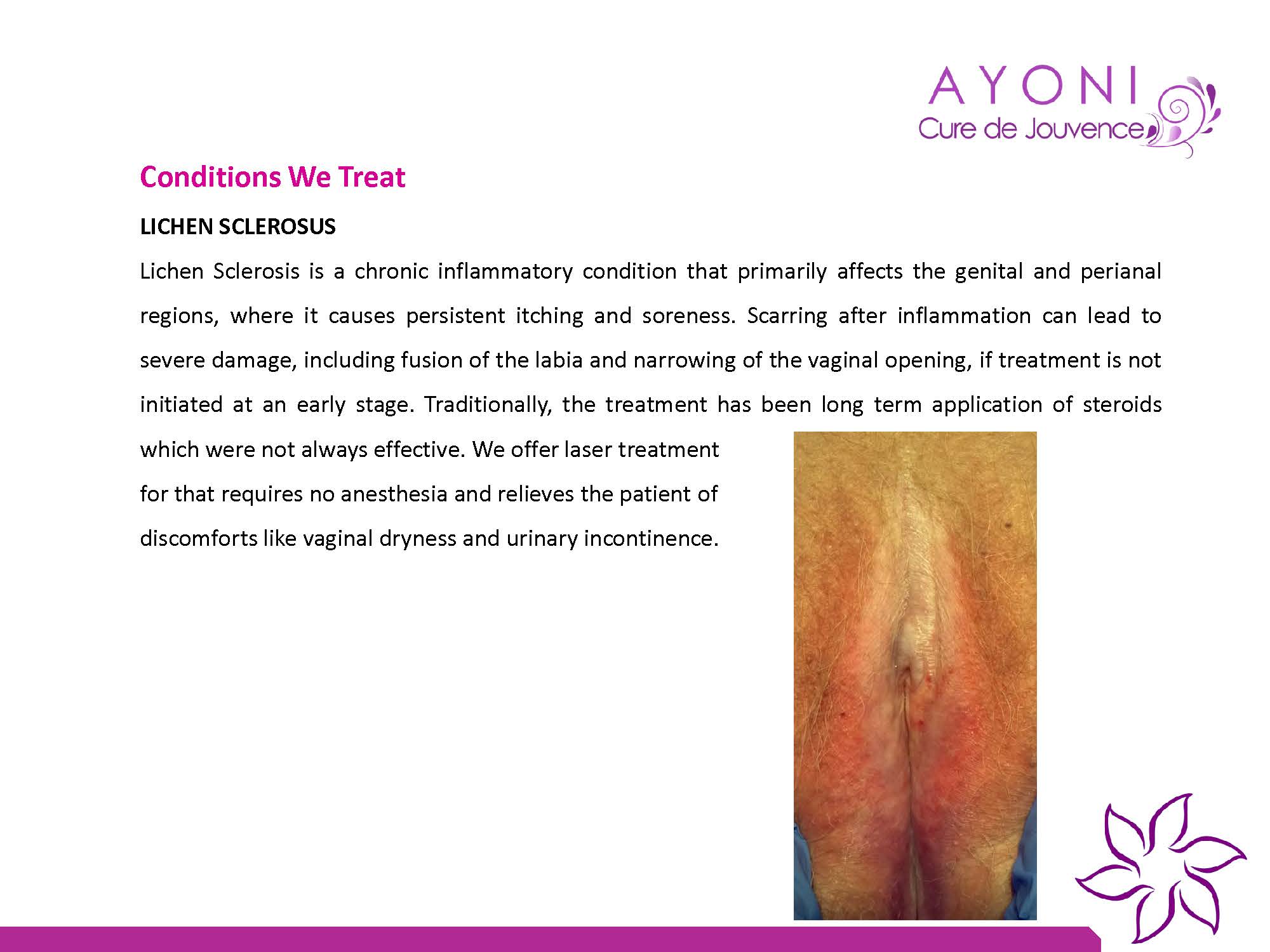 Ayoni Cure De Jouvence Image 7