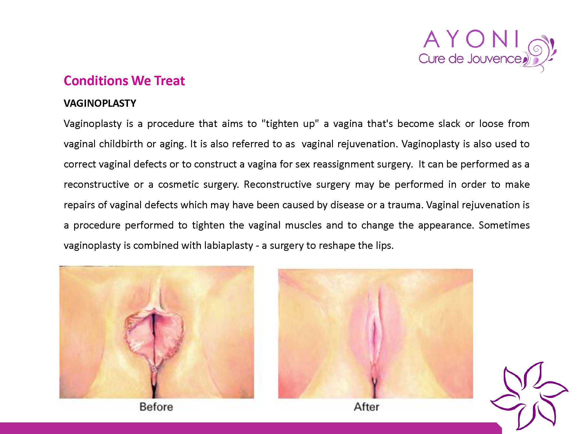 Ayoni Cure De Jouvence Image 10
