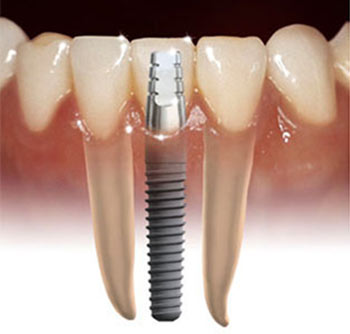 ranjan dental clinic & smile gallerry Image 2