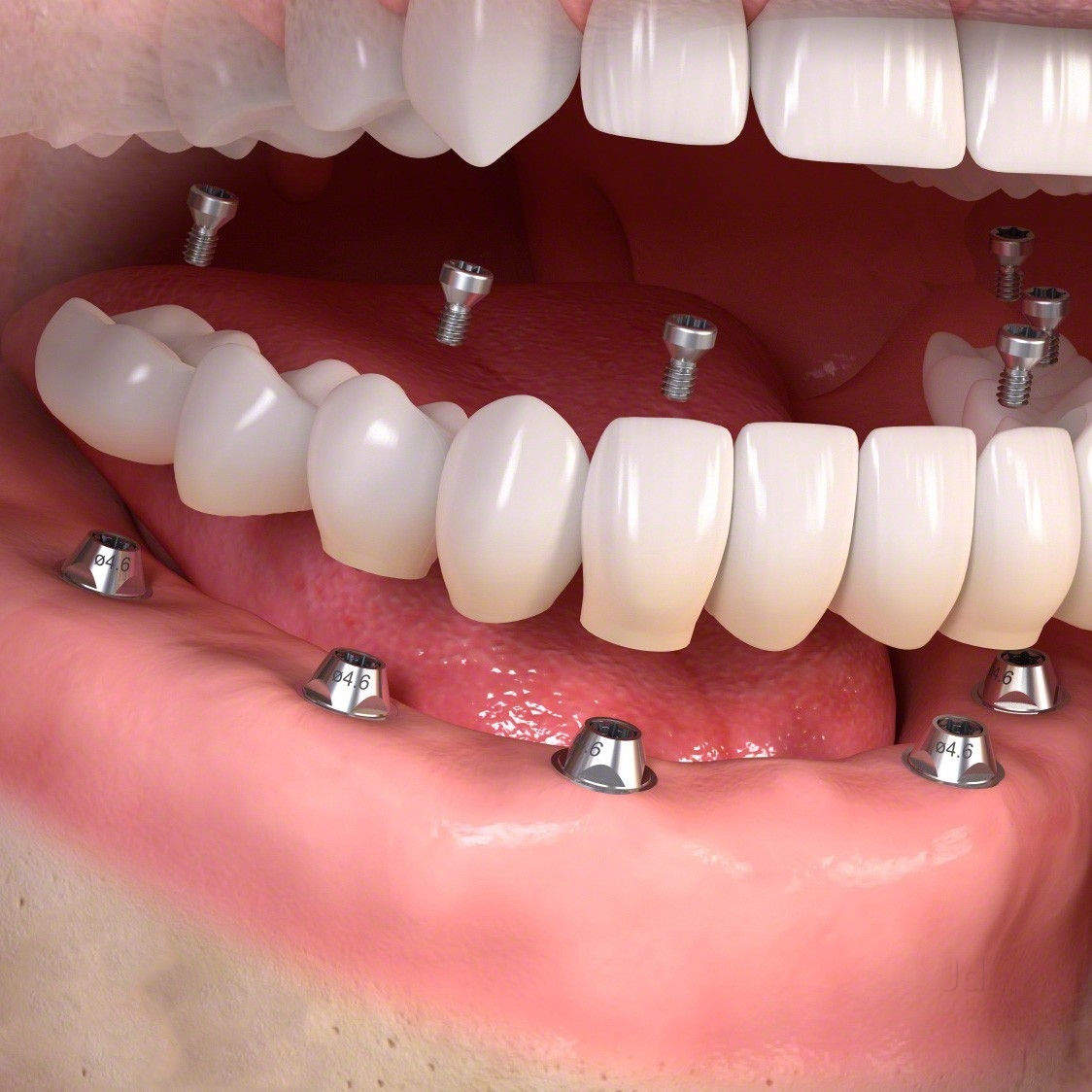 Smile Dental Care & Implant Centre Image 8
