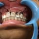 Smile Dental Care & Implant Centre Image 3