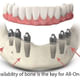 Smile Dental Care & Implant Centre Image 6