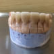 Smile Dental Care & Implant Centre Image 9