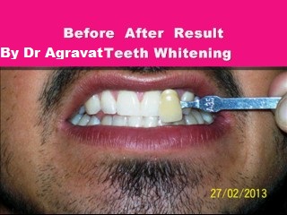 Dr Bharat Agravat Cosmetic Laser Dental Implant Clinic Image 1