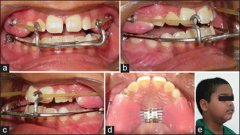 sai dental clinic Image 1