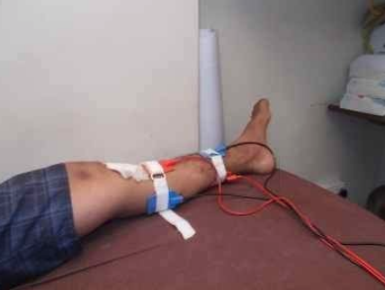 Dr. Sahil Advanced Physiotherapy & Rehab Centre Image 1