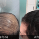 Sparsh - Skin,Hair, Slimming,Antiaging clinic Image 6