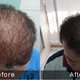 Sparsh - Skin,Hair, Slimming,Antiaging clinic Image 4