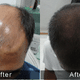 Sparsh - Skin,Hair, Slimming,Antiaging clinic Image 5