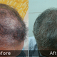 Sparsh - Skin,Hair, Slimming,Antiaging clinic Image 7