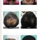 Sparsh - Skin,Hair, Slimming,Antiaging clinic Image 3