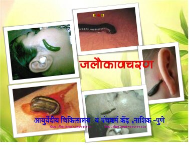 SHREE VISHWAVALLABH AYURVEDIC PANCHAKARMA & GARBHASANSKAR CENTER Image 6
