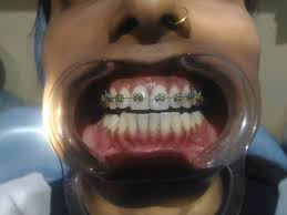 Quality Dental Cares Image 2