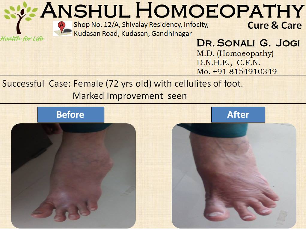 Anshul Homoeopathy Cure & Care Image 10