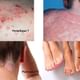 Dr AJ Kanwar's Skin Clinic Image 1